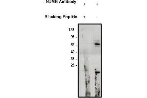 Image no. 1 for anti-Numb Homolog (NUMB) antibody (ABIN4620367) (NUMB Antikörper)