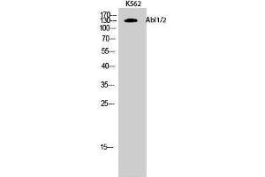 Western Blotting (WB) image for anti-Abelson Murine Leukemia Viral Oncogene Homolog 1/2 (ABL1/ABL2) (Lys5) antibody (ABIN3173634) (ABL1/2 Antikörper  (Lys5))