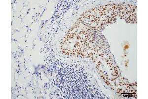 Immunohistochemistry analysis using Rat Anti-HSF1 Monoclonal Antibody, Clone 4B4 . (HSF1 Antikörper  (AA 425-439) (PE))