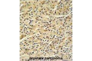 Immunohistochemistry (IHC) image for anti-Homeobox A3 (HOXA3) antibody (ABIN3004366) (HOXA3 Antikörper)