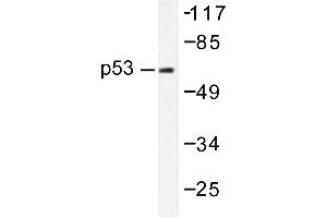 Image no. 1 for anti-Tumor Protein P53 (TP53) antibody (ABIN271768) (p53 Antikörper)