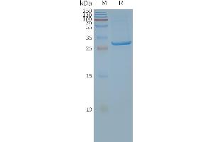 Human A4-Nanodisc, Flag Tag on SDS-PAGE (SLC25A4 Protein)