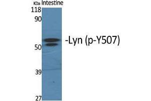 Western Blot (WB) analysis of specific cells using Phospho-Lyn (Y508) Polyclonal Antibody. (LYN Antikörper  (pTyr508))