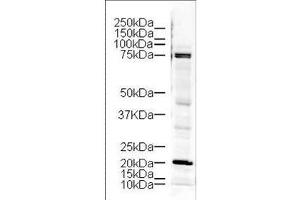 Western blot using  Affinity Purified anti-LIM Kinase antibody shows detection of a 73 kDa band corresponding to LIM kinase in lysates from mouse brain. (LIM Domain Kinase 1 Antikörper  (AA 630-647))