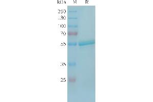 Human TR Protein, hFc Tag on SDS-PAGE under reducing condition. (TREML1 Protein (AA 16-162) (Fc Tag))