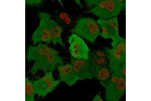 Immunofluorescence (IF) image for anti-Ubiquitin Carboxyl-terminal Esterase L1 (Ubiquitin Thiolesterase) (UCHL1) antibody (ABIN6940856)