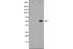 Western blot analysis of NK1R expression in Mouse lung lysate The lane on the left is treated with the antigen-specific peptide. (TACR1 Antikörper  (Internal Region))
