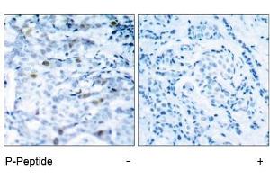 Image no. 1 for anti-Cyclin-Dependent Kinase 1 (CDK1) (pThr161) antibody (ABIN196846) (CDK1 Antikörper  (pThr161))