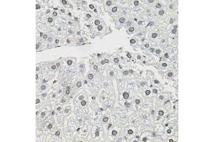 Immunohistochemistry of paraffin-embedded mouse liver using TCEB1 antibody (ABIN5999020) (40x lens). (TCEB1 Antikörper)