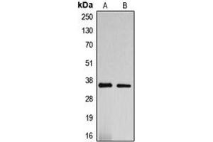 Western blot analysis of DNAJC17 expression in HepG2 (A), SP2/0 (B) whole cell lysates. (DNAJC17 Antikörper  (N-Term))