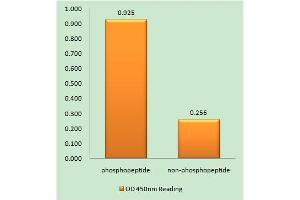 Immunohistochemistry analysis of paraffin-embedded human brain tissue using ITCH (Phospho-Tyr420) antibody. (ITCH Antikörper  (pTyr420))