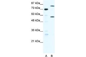WB Suggested Anti-MYNN Antibody Titration:  1. (Myoneurin Antikörper  (Middle Region))