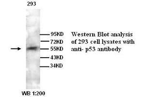 Image no. 1 for anti-Tumor Protein P53 (TP53) antibody (ABIN790965) (p53 Antikörper)