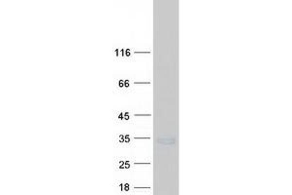 SEC22A Protein (Myc-DYKDDDDK Tag)