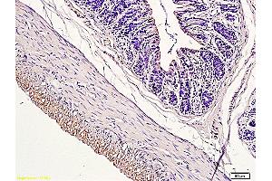 Immunohistochemistry (IHC) image for anti-CD163 (CD163) (AA 1001-1121) antibody (ABIN741570)