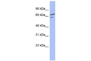 WB Suggested Anti-PGM1 Antibody Titration: 0. (Phosphoglucomutase 1 Antikörper  (Middle Region))