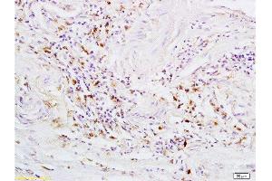 Immunohistochemistry (Paraffin-embedded Sections) (IHC (p)) image for anti-G Protein-Coupled Estrogen Receptor 1 (GPER) (AA 251-375) antibody (ABIN685717)