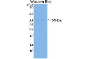 Western Blotting (WB) image for anti-Adenylate Cyclase 1 (Brain) (ADCY1) (AA 303-569) antibody (ABIN2118680) (ADCY1 Antikörper  (AA 303-569))