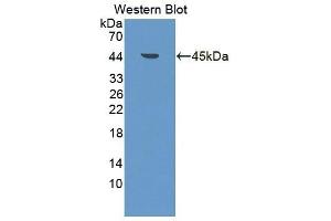 Detection of Recombinant BNIP3, Rat using Polyclonal Antibody to Bcl2/Adenovirus E1B 19 kDa Interacting Protein 3 (BNIP3) (BNIP3 Antikörper  (AA 3-134))