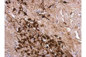 Immunohistochemistry (IHC) image for anti-Calbindin 2 (CALB2) antibody (ABIN2855596)