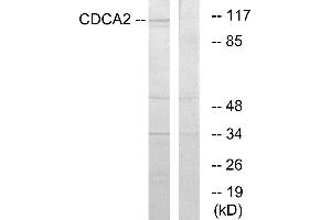 Western blot analysis of extracts from 293 cells, using CDCA2 antibody. (CDCA2 Antikörper)