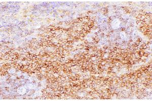 Immunohistochemistry of paraffin-embedded Rat spleen using CD38 Polycloanl Antibody at dilution of 1:200 (CD38 Antikörper)