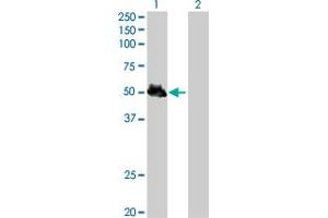 Western Blot analysis of KRT8 expression in transfected 293T cell line by KRT8 MaxPab polyclonal antibody. (KRT8 Antikörper  (AA 1-483))