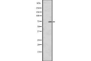 Western blot analysis of CNNM1 expression in Human tonsil tissue lysate,The lane on the left is treated with the antigen-specific peptide. (Cyclin M1 Antikörper)