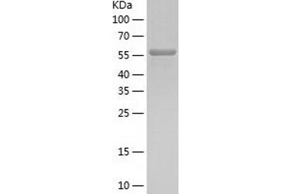 Catalase Protein (CAT) (AA 1-527) (His tag)