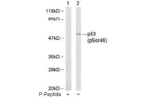 Image no. 1 for anti-Tumor Protein P53 (TP53) (pSer46) antibody (ABIN196786) (p53 Antikörper  (pSer46))