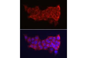 Immunofluorescence analysis of A-431 cells using Cytokeratin 14 (KRT14) Rabbit pAb (ABIN7268092) at dilution of 1:150 (40x lens). (KRT14 Antikörper  (C-Term))