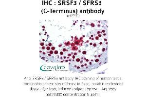 Image no. 1 for anti-serine/arginine-Rich Splicing Factor 3 (SRSF3) antibody (ABIN1739659) (SRSF3 Antikörper)