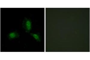 Immunofluorescence analysis of HeLa cells, using IRS-1 (Ab-312) Antibody. (IRS1 Antikörper  (AA 279-328))