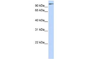 WB Suggested Anti-ZNF175 Antibody Titration:  0. (ZNF175 Antikörper  (C-Term))