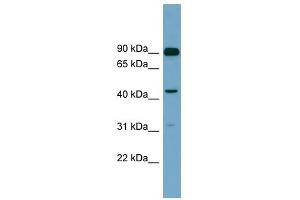 DGKA antibody used at 1 ug/ml to detect target protein. (DGKA Antikörper  (N-Term))