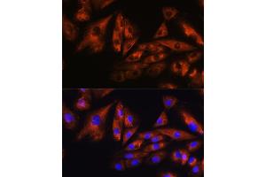 Immunofluorescence analysis of H9C2 cells using  Rabbit pAb (ABIN1678800, ABIN3019073, ABIN3019074 and ABIN6220701) at dilution of 1:100. (Ataxin 10 Antikörper  (AA 346-475))