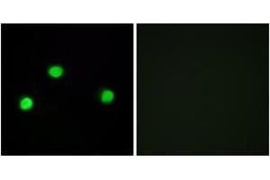 Immunofluorescence analysis of COS7 cells, using IP6K2 Antibody. (IP6K2 Antikörper  (AA 161-210))