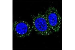 Confocal immunofluorescent analysis of anti-AKT2 antibody with HeLa cells followed by Alexa Fluor 488-conjugated goat anti-mouse lgG (green). (AKT2 Antikörper)