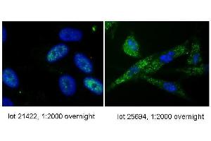 Immunofluorescence (IF) image for anti-Telomerase Reverse Transcriptase (TERT) (C-Term) antibody (ABIN6655270)