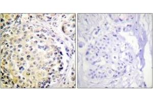 Immunohistochemistry (IHC) image for anti-Vimentin (VIM) (AA 31-80) antibody (ABIN2888938) (Vimentin Antikörper  (AA 31-80))