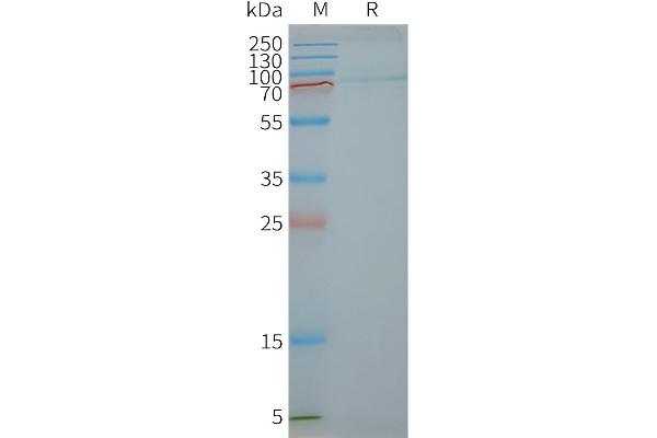 FSHR Protein