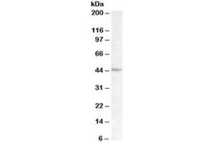 Western blot testing of Daudi lysate with LHX2 antibody at 1ug/ml. (LHX2 Antikörper)