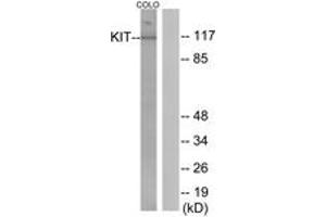 Western Blotting (WB) image for anti-Mast/stem Cell Growth Factor Receptor (KIT) (AA 906-955) antibody (ABIN2888670) (KIT Antikörper  (AA 906-955))