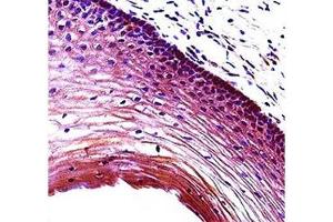 Puma antibody immunohistochemistry analysis in formalin fixed and paraffin embedded human cervix tissue. (PUMA Antikörper  (AA 109-137))