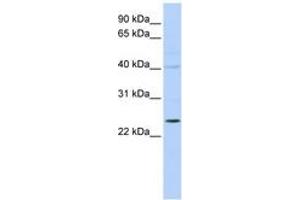 Image no. 1 for anti-Kv Channel Interacting Protein 2 (KCNIP2) (N-Term) antibody (ABIN6742581) (KCNIP2 Antikörper  (N-Term))