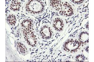 Immunohistochemical staining of paraffin-embedded Human breast tissue using anti-OBFC2B mouse monoclonal antibody. (SSBP1 Antikörper)