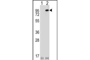 Western blot analysis of WHSC1L1 (arrow) using rabbit polyclonal WHSC1L1 Antibody (N-term) (ABIN656685 and ABIN2845923). (WHSC1L1 Antikörper  (N-Term))
