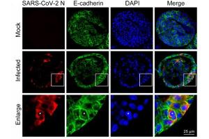 Immunofluorescence (IF) image for anti-SARS-Coronavirus Nucleocapsid Protein (SARS-CoV N) antibody (ABIN6952544)