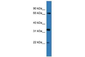 Western Blot showing DOK4 antibody used at a concentration of 1-2 ug/ml to detect its target protein. (DOK4 Antikörper  (N-Term))