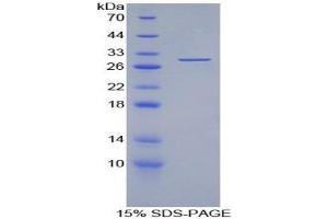 SDS-PAGE analysis of Human Torsin 3A Protein. (TOR3A Protein)